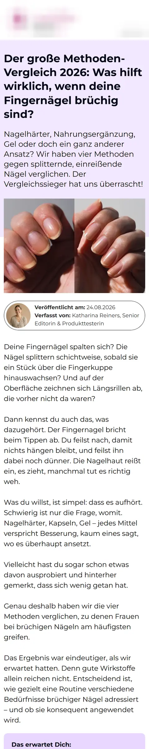 Vergleichsseite für eine Nagelpflege-Brand: Der große Methoden-Vergleich bei brüchigen Fingernägeln